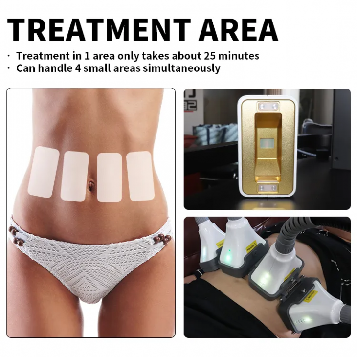 Aparat de slabit LIPOLASER, 1060NM DIODE LASER BODY SLIMMING, Skin Tightening, Indepartarea grasimii, Pierdere in Greutate, Indepartarea Pigmentului, Reducerea Celulitei, Modelarea Corpului