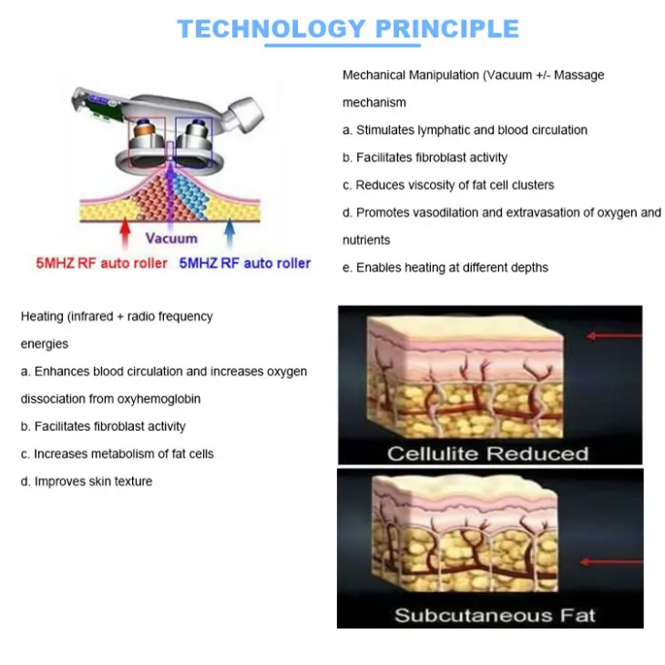 Aparat de Reducere a Grasimi, Vela3 Cavitation Vaccum Rf si Presiune Negativa, Body Slimming Machine 9in1, Contouring and Shaping,  Pierderea în Greutate, Intinerirea Pielii