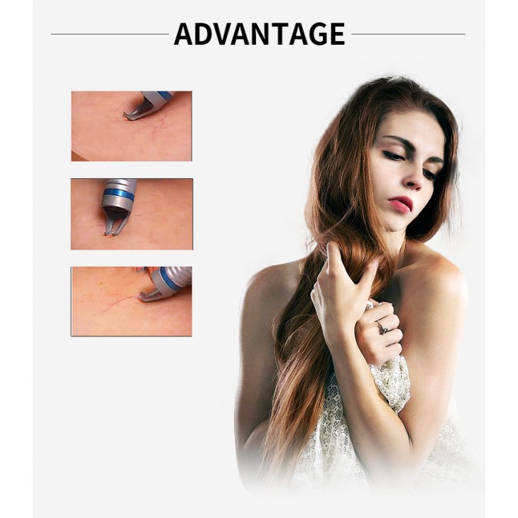 Aparat Dioda Laser 980nm, Indepartare venectazii, Vase capilare sparte, Indepartare Vene panza de paianjen, Venom Car15W