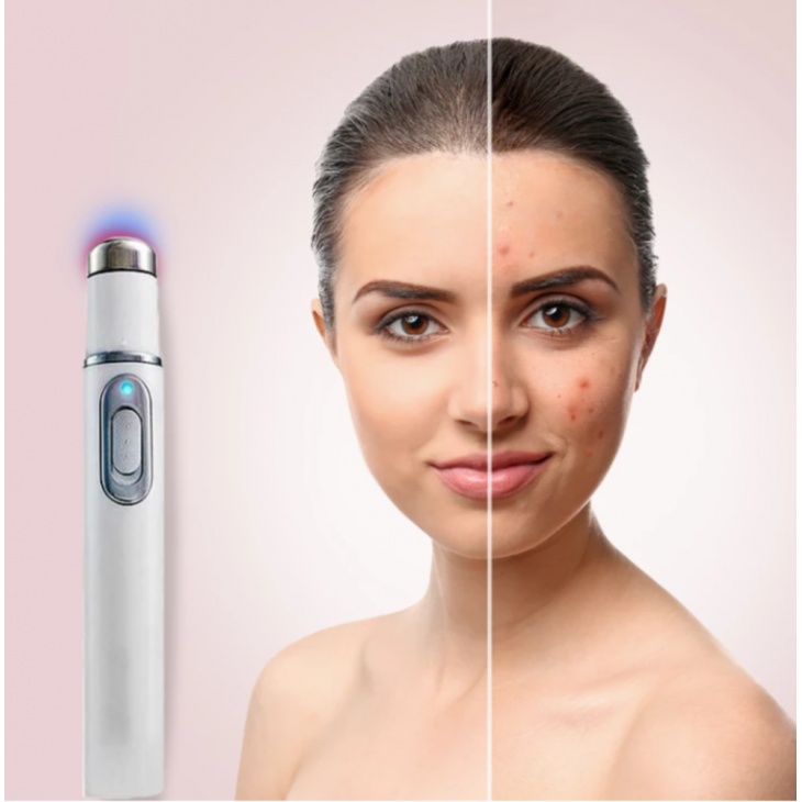Aparat cosmetic Antiacnee 415NM Blue-Ray Laser, Curatarea Tenului si Lifting, Indepartare Cuperoza, Blue Light Skin Therapy