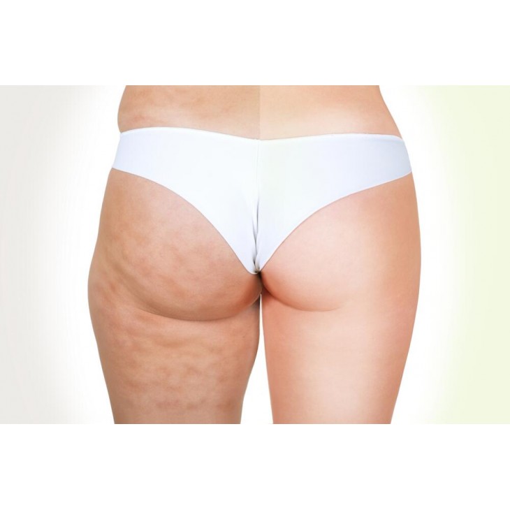 Aparat Infrarosu LCD Detox Body Drenaj limfatic, Aparat de slabit Presoterapie, Pierdere in greutate, Anti Celulita, PureMax