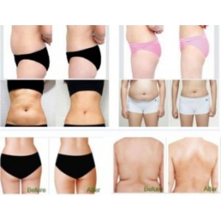 Aparat Ultrasunete Plutonix HIFU Tonifiere si Slabire Corp, Indepartarea Celulitei, Intinerirea pielii - Energie cu ultrasunete concentrata la intensitate ridicata Hello Body, Gel Corp Cadou