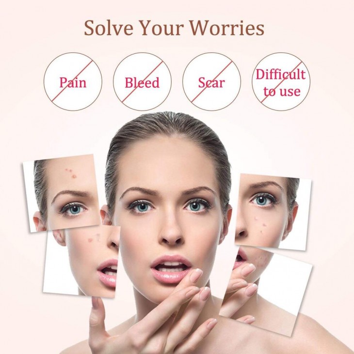 Aparat Plasma Pen Indepartarea Petelor, Alunitelor, Pistruilor, Ecran LCD, Antiacnee 1 Mole Removal, Floral Rose